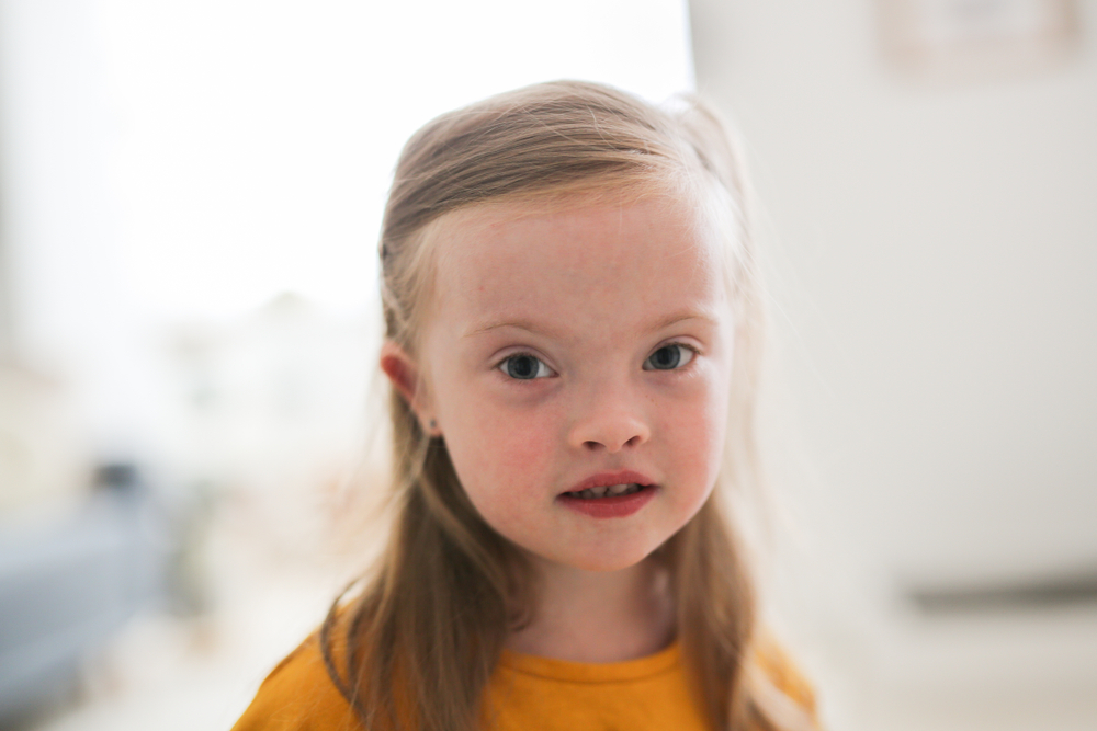 Adopted girl with special needs smiling